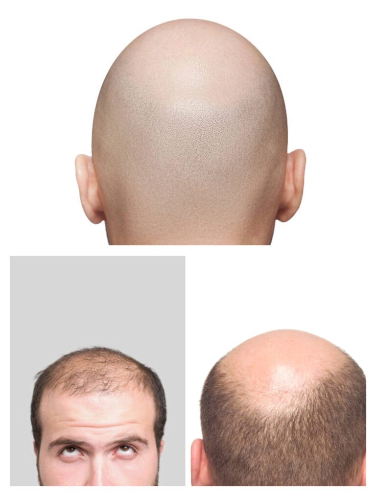 बुलढाणा जिल्ह्यातील गाई गावात विचित्र आजाराचा कहर, नागरिकांमध्ये भीतीचे वातावरण